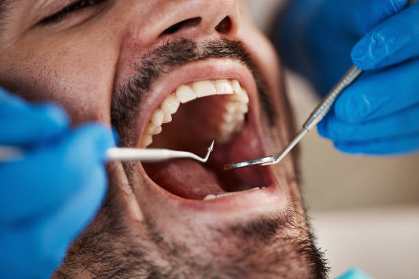 Best Emergency Care for Gum Disease in Sheffield, OH